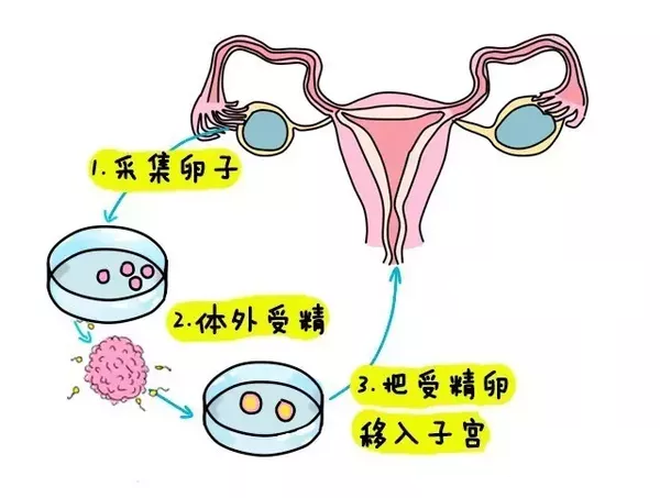 正规捐卵试管机构排行榜